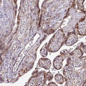 Anti-FMR1 antibody produced in rabbit Prestige Antibodies&#174; Powered by Atlas Antibodies, affinity isolated antibody, buffered aqueous glycerol solution