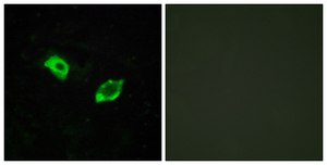 Anti-GPR158 antibody produced in rabbit affinity isolated antibody