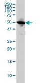 Monoclonal Anti-TUBA6 antibody produced in mouse clone S11, purified immunoglobulin, buffered aqueous solution