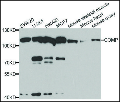 Anti-COMP antibody produced in rabbit affinity isolated antibody