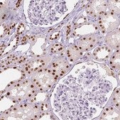 Monoclonal Anti-HNF1B antibody produced in mouse Prestige Antibodies&#174; Powered by Atlas Antibodies, clone CL0374, purified immunoglobulin, buffered aqueous glycerol solution