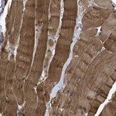 Anti-APOBEC2 antibody produced in rabbit Prestige Antibodies&#174; Powered by Atlas Antibodies, affinity isolated antibody, buffered aqueous glycerol solution