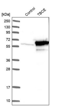 Anti-TBCE antibody produced in rabbit Prestige Antibodies&#174; Powered by Atlas Antibodies, affinity isolated antibody, buffered aqueous glycerol solution, Ab2