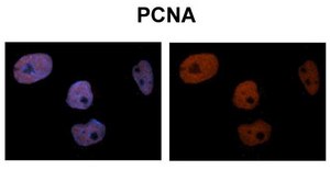 Anti-PCNA IgG fraction of antiserum