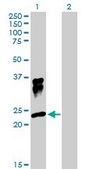 Anti-ORM1 antibody produced in rabbit purified immunoglobulin, buffered aqueous solution