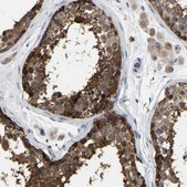 Anti-GARS antibody produced in rabbit Prestige Antibodies&#174; Powered by Atlas Antibodies, affinity isolated antibody, buffered aqueous glycerol solution