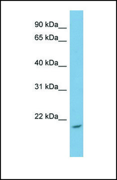 Anti-NME4 antibody produced in rabbit affinity isolated antibody