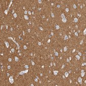 Anti-TNR antibody produced in rabbit Prestige Antibodies&#174; Powered by Atlas Antibodies, affinity isolated antibody, buffered aqueous glycerol solution, Ab1