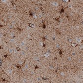 Monoclonal Anti-GLUL antibody produced in mouse Prestige Antibodies&#174; Powered by Atlas Antibodies, clone CL3004, purified immunoglobulin, buffered aqueous glycerol solution
