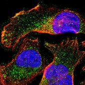 Anti-SLC27A4 antibody produced in rabbit Prestige Antibodies&#174; Powered by Atlas Antibodies, affinity isolated antibody, buffered aqueous glycerol solution