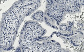 Anti-AHR Antibody, clone 1H8 ZooMAb&#174; Rabbit Monoclonal recombinant, expressed in HEK 293 cells
