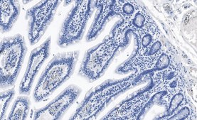 Anti-ErbB-3/HER3 Antibody, clone 1C8 ZooMAb&#174; Rabbit Monoclonal recombinant, expressed in HEK 293 cells