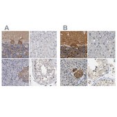 Anti-GDAP1 antibody produced in rabbit Prestige Antibodies&#174; Powered by Atlas Antibodies, affinity isolated antibody, buffered aqueous glycerol solution