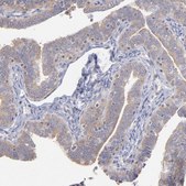 Anti-RPLP0 antibody produced in rabbit Prestige Antibodies&#174; Powered by Atlas Antibodies, affinity isolated antibody, buffered aqueous glycerol solution