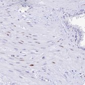 Anti-PRPS1 antibody produced in rabbit Prestige Antibodies&#174; Powered by Atlas Antibodies, affinity isolated antibody, buffered aqueous glycerol solution