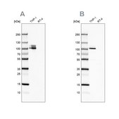 Anti-ITGB2 antibody produced in rabbit Prestige Antibodies&#174; Powered by Atlas Antibodies, affinity isolated antibody, buffered aqueous glycerol solution