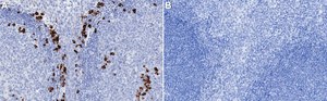Anti-MZB1 Antibody, clone 1J15 ZooMAb&#174; Rabbit Monoclonal recombinant, expressed in HEK 293 cells