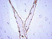 Anti-von Willebrand Factor Antibody Chemicon&#174;, from rabbit