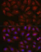 Anti- AMPK&#945;2 antibody produced in rabbit