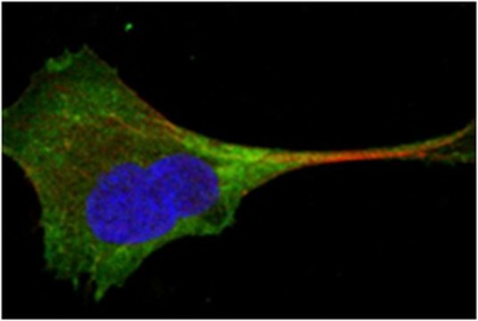 Anti-WNT10B Antibody, clone 5A7 ascites fluid, clone 5A7, from mouse