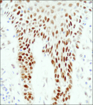 Rabbit anti-p53 Antibody, Affinity Purified