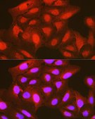 Anti-Phospho-PDPK1-S241 antibody produced in rabbit