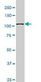 Monoclonal Anti-MUSK antibody produced in mouse clone 1F3, purified immunoglobulin, buffered aqueous solution