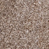 Anti-CKS2 antibody produced in rabbit Prestige Antibodies&#174; Powered by Atlas Antibodies, affinity isolated antibody, buffered aqueous glycerol solution