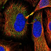 Anti-GSTM1 antibody produced in rabbit Prestige Antibodies&#174; Powered by Atlas Antibodies, affinity isolated antibody, buffered aqueous glycerol solution