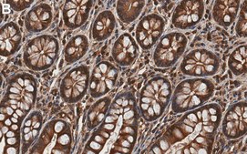 Anti-Calpain-1 Antibody, clone 1H14 ZooMAb&#174; Rabbit Monoclonal recombinant, expressed in HEK 293 cells