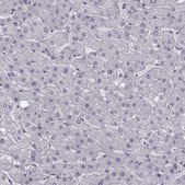 Anti-LRP8 Prestige Antibodies&#174; Powered by Atlas Antibodies, affinity isolated antibody