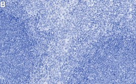 Anti-MZB1 Antibody, clone 1J15 ZooMAb&#174; Rabbit Monoclonal recombinant, expressed in HEK 293 cells
