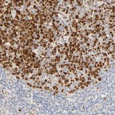 Anti-MEF2B antibody produced in rabbit Prestige Antibodies&#174; Powered by Atlas Antibodies, affinity isolated antibody, buffered aqueous glycerol solution