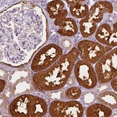 Anti-SHMT1 antibody produced in rabbit Prestige Antibodies&#174; Powered by Atlas Antibodies, affinity isolated antibody, buffered aqueous glycerol solution