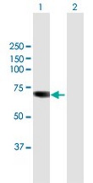 Anti-TKTL1 antibody produced in mouse purified immunoglobulin, buffered aqueous solution