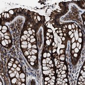Anti-CCT8 antibody produced in rabbit Prestige Antibodies&#174; Powered by Atlas Antibodies, affinity isolated antibody, buffered aqueous glycerol solution