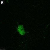 Anti-pan-Na+ Channel Antibody, clone 4B8 ZooMAb&#174; Rabbit Monoclonal recombinant, expressed in HEK 293 cells