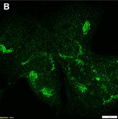 Anti-&#945;-amylase Antibody, clone 1G14 ZooMAb&#174; Rabbit Monoclonal recombinant, expressed in HEK 293 cells
