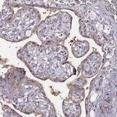 Anti-PRKCZ antibody produced in rabbit Prestige Antibodies&#174; Powered by Atlas Antibodies, affinity isolated antibody, buffered aqueous glycerol solution