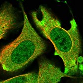 Anti-PRKD3 antibody produced in rabbit Prestige Antibodies&#174; Powered by Atlas Antibodies, affinity isolated antibody, buffered aqueous glycerol solution