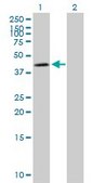 Anti-NDUFS2 antibody produced in mouse IgG fraction of antiserum, buffered aqueous solution