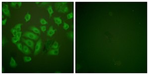 Anti-Stefin A antibody produced in rabbit affinity isolated antibody