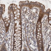 Anti-SFXN2 antibody produced in rabbit Prestige Antibodies&#174; Powered by Atlas Antibodies, affinity isolated antibody, buffered aqueous glycerol solution