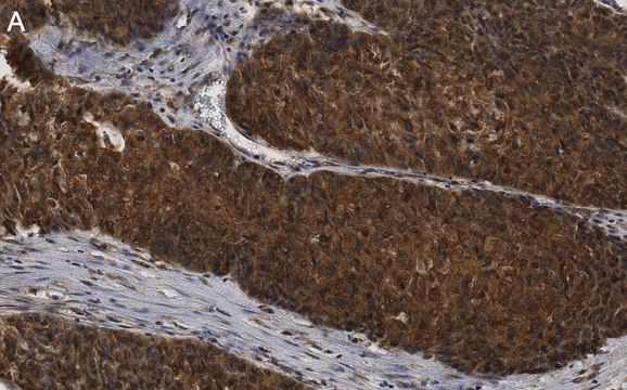 Anti-ANKZF1 Antibody, clone 1D4 ZooMAb&#174; Rabbit Monoclonal recombinant, expressed in HEK 293 cells