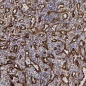Anti-SLC9A3R2 antibody produced in rabbit Prestige Antibodies&#174; Powered by Atlas Antibodies, affinity isolated antibody, buffered aqueous glycerol solution