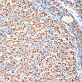 Anti-Slit2 Antibody, clone 1T5A3, Rabbit Monoclonal