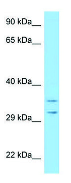 Anti-RPS2 antibody produced in rabbit affinity isolated antibody