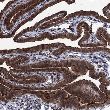 Anti-EYA4 antibody produced in rabbit Prestige Antibodies&#174; Powered by Atlas Antibodies, affinity isolated antibody, buffered aqueous glycerol solution