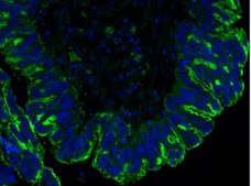 Anti-Mucin-16 (CA-125) Antibody, clone 5E11 clone 5E11, from mouse
