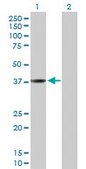 Anti-CTSL1 antibody produced in rabbit purified immunoglobulin, buffered aqueous solution